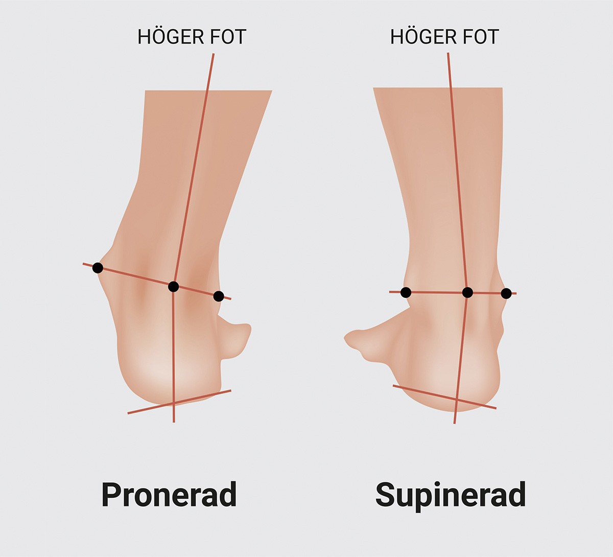 Pronation & Supination - Ortolab - leader of insoles